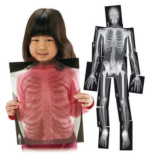 Röntgenfotos „My Body“
